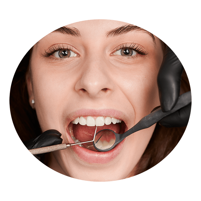 teethcleaning teethcleaning